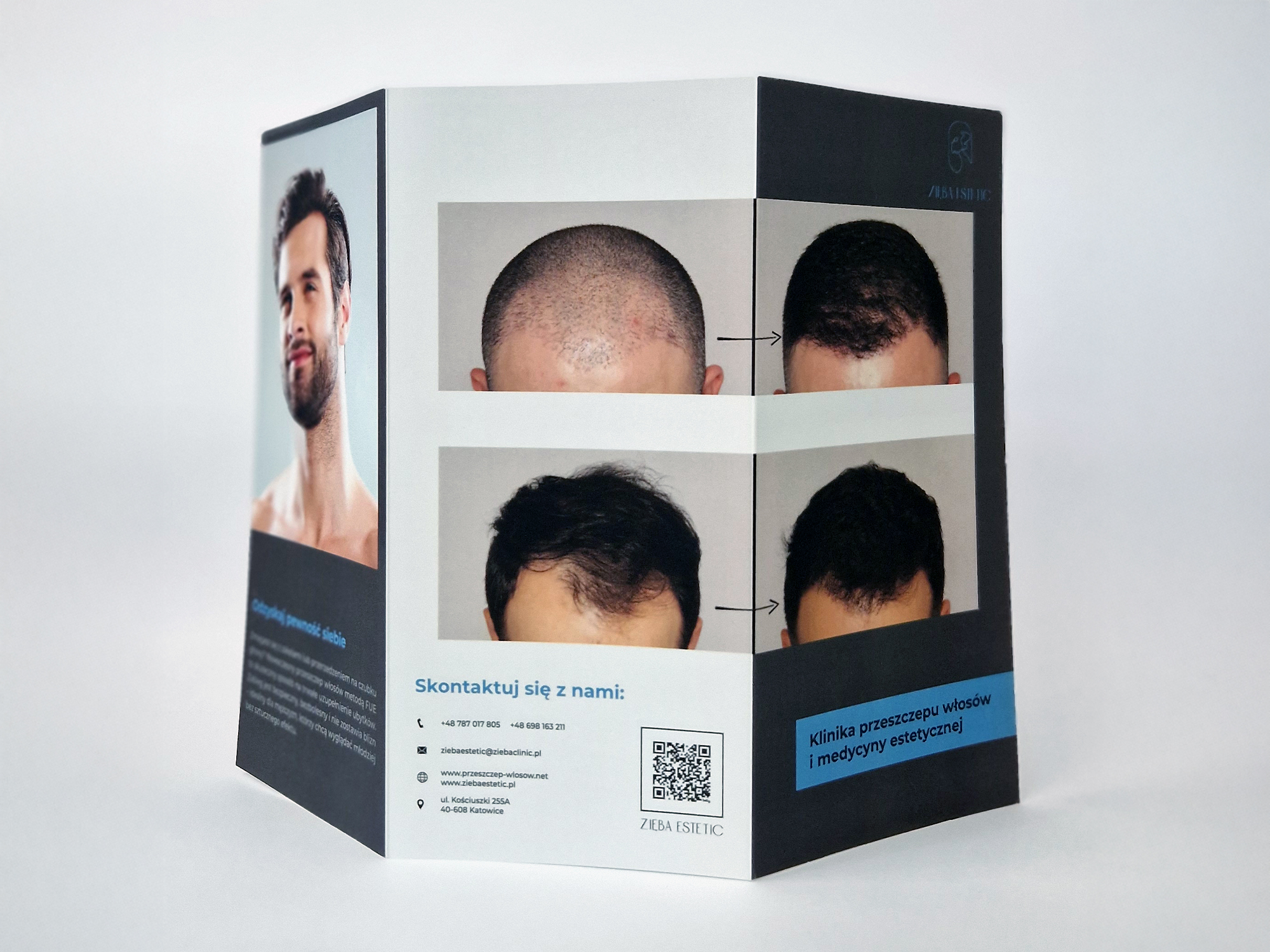 Ulotka trójdzielna - przeszczepy włosów strona druga